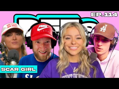 SCAR GIRL REVEALS ALL — BFFs EP. 114