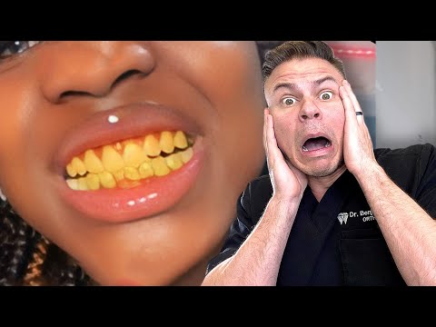 5 Things To Avoid YELLOW Teeth RIGHT NOW! 🦷😮